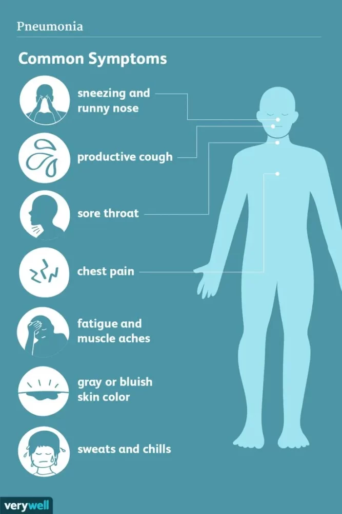 Pneumonia Common Symptoms