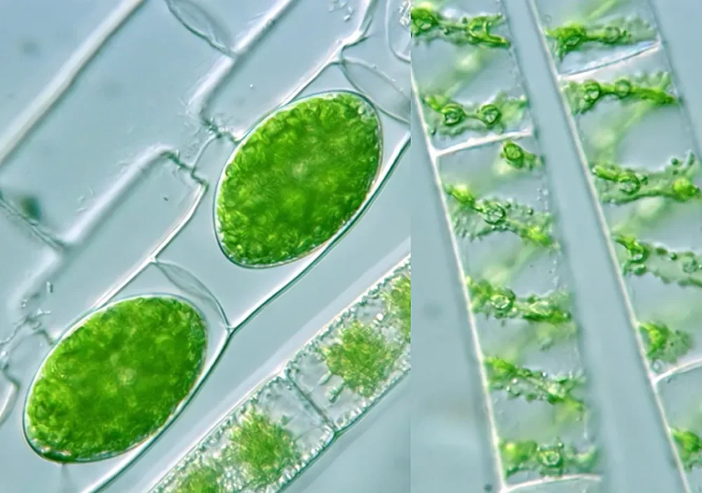 Spirogyra